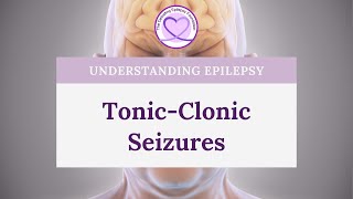 What are TonicClonic Seizures [upl. by Ahsaek]