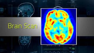 Understanding Nuclear Medicine [upl. by Kapeed]